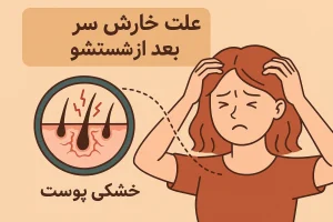 علت خارش سر بعد از شستشو