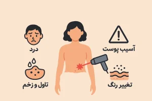 مضرات لیزر بیکینی